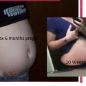 Pregnancy Singleton vs. Twins.