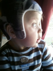 Lucas outgrew his cranial band 2