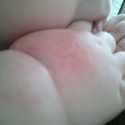 biting